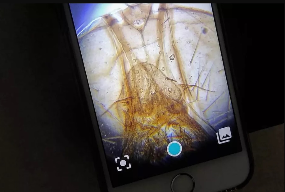 Le microscope sur smartphone : vous êtes une majorité à apprécier à cette  fonctionnalité