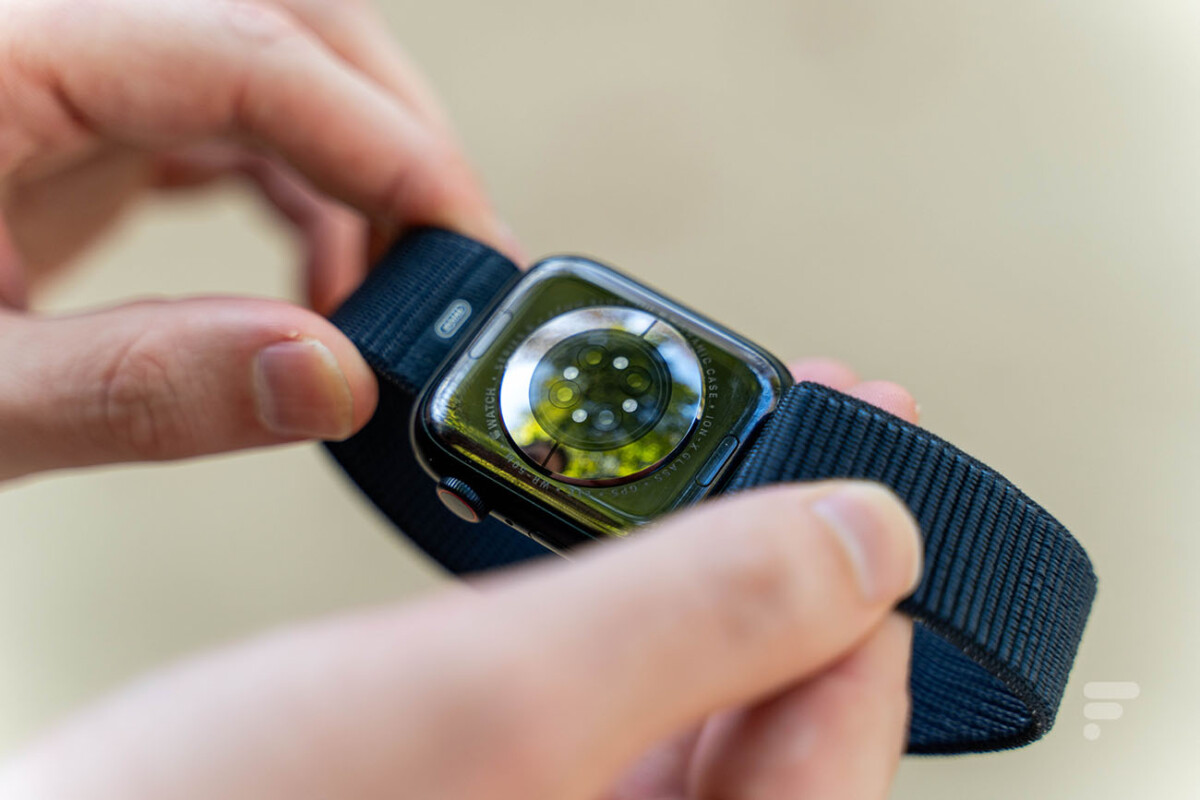 The heart rate monitor and pulse oximeter on the back of the Apple Watch Series 9