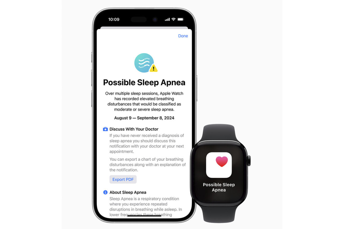 La mesure d'apnée du sommeil arrive sur les Apple Watch Series 10... et Series 9